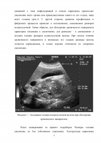 Ультразвуковая диагностика заболеваний поджелудочной железы воспалительного генеза Образец 57445