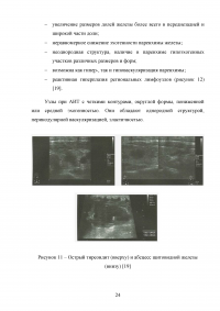 Ультразвуковкое исследование щитовидной железы Образец 98550