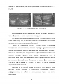 Ультразвуковкое исследование щитовидной железы Образец 98554
